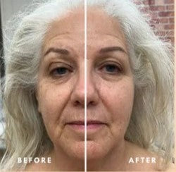 Lava™ Lymphatic Face Brush
